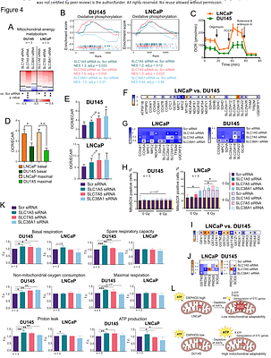 Glutamine transporters regulate prostate cancer radiosensitivity through NUPR1-mediated stress response