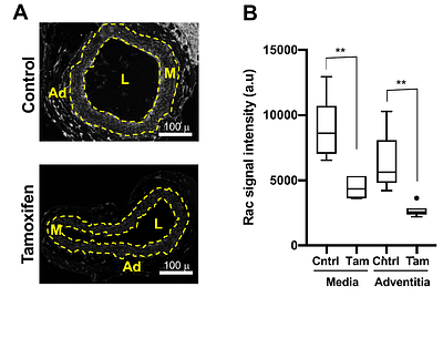 Arterial mechanics, extracellular matrix, and smooth muscle differentiation in carotid arteries deficient for Rac1