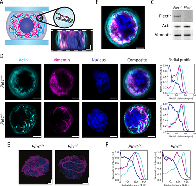 Plectin affects cell viscoelasticity at small and large deformations