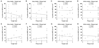 Disrupted myelin homeostasis in grey matter of Alzheimer's disease