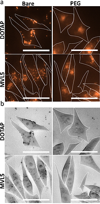 Multivalent Lipid MVL5 Micellar Nanoparticles Exhibit Dramatically Increased Loading of Paclitaxel with PEGylation Enhancing Human Cancer Cell Penetration Depth and Cytotoxicity