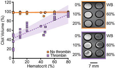MRI-Based Blood Clot Phenotyping: An In Vitro Study