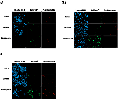 Sweet taste receptor regulates proliferation and glucose uptake in glioblastoma cells