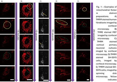 Beyond Pulsing Dyes: Are Flickers the Language of the Mitochondrial Network?