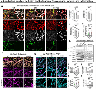The Nuclear-Cytoskeletal Interface Is a Vulnerability in Aging Endothelium