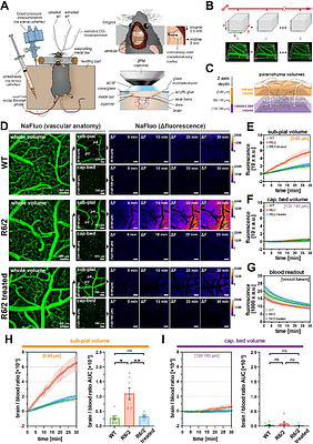 Vascular dysfunction in Huntington's disease is located at the blood-CSF barrier and is rescued by sphingosine-1-phosphate receptor agonist