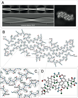 Cryo-EM structures of Alpha-Synuclein(31-100) amyloid fibrils reveal disease-like structural motifs without reproducing the Parkinson's Disease polymorph