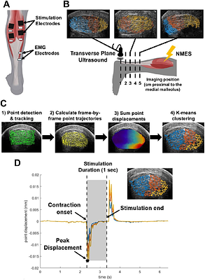 In vivo characterization of Achilles subtendon function and morphology within the tendon cross section and along the free tendon