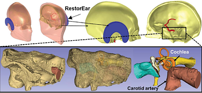 Physiological limits of localized hypothermia in the human cochlea: The role of vascular heat transport