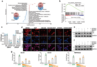 A novel AR molecular glue degrader via bivalent engagement of the N-terminal domain and RNF213-UBE2J2 complex