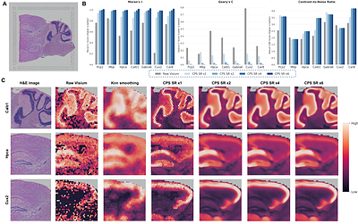 CPS: Mapping Physical Coordinates to High-Fidelity Spatial Transcriptomics via Privileged Multi-Scale Context Distillation