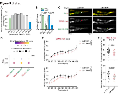 Dynamic dissociation of the IFT complex drives ciliary dysfunction during C. elegans ageing