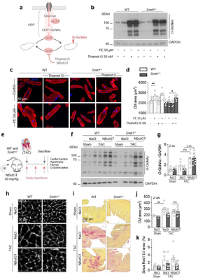 Sodium myo-inositol cotransporter-1, SMIT1, promotes cardiac hypertrophy and fibrosis in pressure overloaded mouse hearts