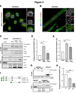 SH3KBP1/CIN85, a new actor of ER-phagy in muscle