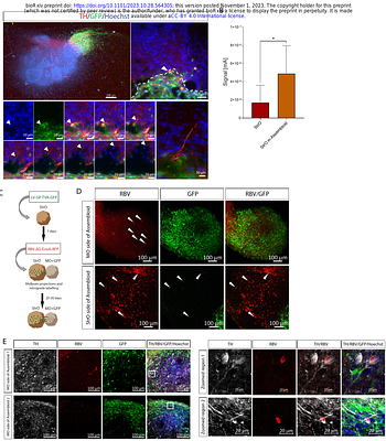 Age-induced midbrain-striatum assembloids model early phenotypes of Parkinsons disease