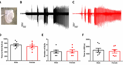 RNA sequencing demonstrates ex vivo neocortical transcriptomic changes induced by epileptiform activity in male and female mice