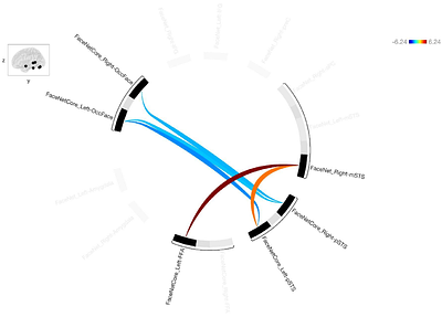 A Neurofeedback therapy of facial expression recognition in Autism shifts connectivity to higher levels within the third visual pathway in relation to clinical improvements