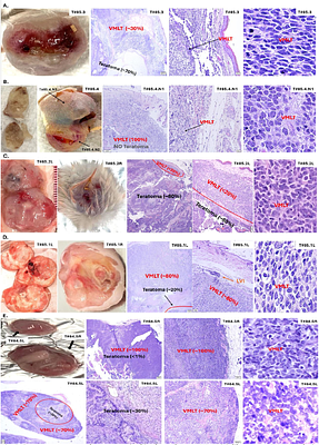 A polyomavirus-positive Merkel cell carcinoma mouse model supports a unified cancer origin