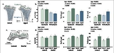 Aging modifies microstructure and material properties of mineralized cartilage and subchondral bone in the murine knee