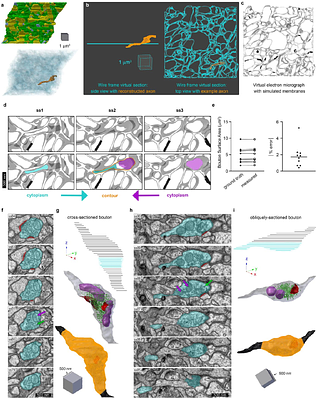 Presynaptic vesicles supply membrane for axonal bouton enlargement during LTP