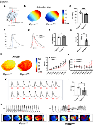Recessive POPDC1 Truncation Causes Lethal Short-QT Pattern Arrhythmogenic Cardiomyopathy with Multi-Ion Channel Remodeling and Ankyrin-G Scaffold Disruption