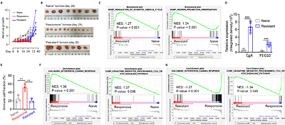 A Glutamine antagonist-modulated tumor microenvironment unleashes enzalutamides immunotherapeutic effects