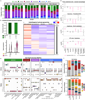 A spatial transcriptomic atlas of acute neonatal lung injury across development and disease severity