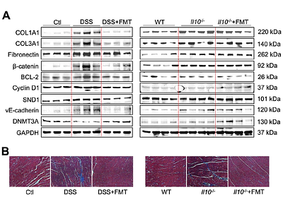 Fecal microbiota transplantation mitigates cardiac remodeling and functional impairment in mice with chronic colitis