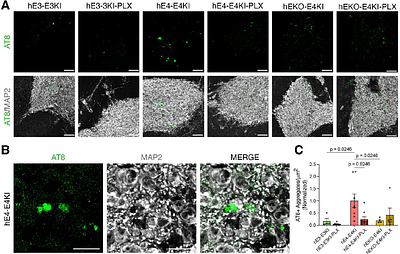 Microglia Depletion Reduces Human Neuronal APOE4-Driven Pathologies in a Chimeric Alzheimer's Disease Model