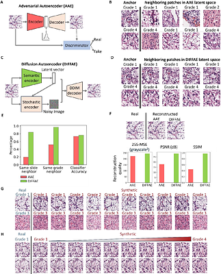 Autonomous learning of pathologists' cancer grading rules