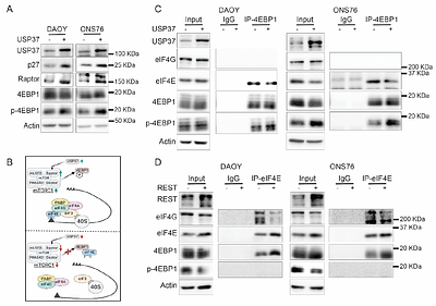 Identification of Raptor and GLI1 as USP37 substrates highlight its context-specific function in medulloblastoma cells.