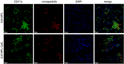 Rational Design of Immunogenic Nanoparticles as a Platform for Enhanced Ovarian Cancer Immunotherapy in Mice