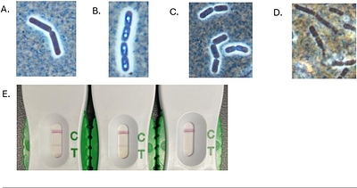 Antimicrobial Resistance Profiling and Phenotypic Characterization of Archived Clinical Bacillus paranthracis Strains