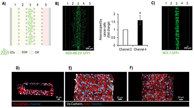 A 3D Tumor-on-a-chip Platform to Identify Drugs that Block Breast Cancer Cell Intravasation