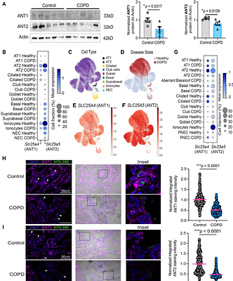 Adenine nucleotide translocase 2 (ANT2) deficiency reprograms ferroptosis in alveolar progenitor cells to promote emphysema