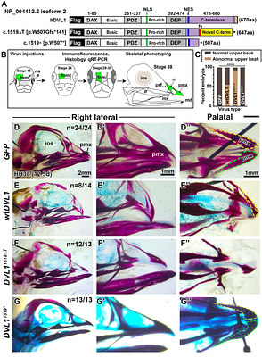 The abnormal C-terminus in DVL1 impacts Robinow Syndrome phenotypes