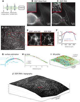 Extended-depth of field random illumination microscopy, EDF-RIM, provides super-resolved projective imaging