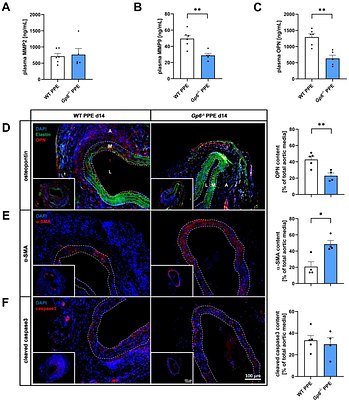 Collagen receptor GPVI-mediated platelet activation and pro-coagulant activity aggravates inflammation and aortic wall remodelling in abdominal aortic aneurysm