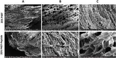 Advancing Therapeutic Solutions: Poloxamer-based Thermosensitive Injectable Hydrogels containing a Self-assembling Peptide for In situ Gelation in an Osteoarthritis Murine Model