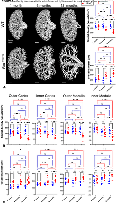 Vascular transcriptional and metabolic changes precede progressive intra-renal microvascular rarefaction in autosomal dominant polycystic kidney disease