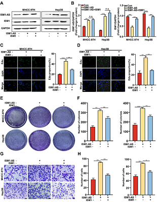 lncRNA-ISM1 Promotes Hepatocellular Carcinoma Progression through RBM10-Mediated Alternative Splicing of ISM1 and Akt-S6-Dependent Glucose Metabolic Reprogramming