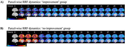 Investigating the variability of physiological response functions across individuals and brain regions in functional magnetic resonance imaging