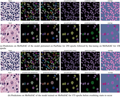 Combining Datasets with Different Label Sets for Improved Nucleus
  Segmentation and Classification