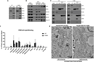 The fatty liver disease-causing protein PNPLA3-I148M alters lipid droplet-Golgi dynamics