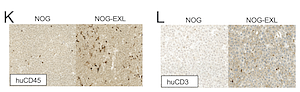 GM-CSF and IL-3 expression increases immune engraftment and tumor infiltration in a humanized patient-derived xenograft model of hepatocellular carcinoma