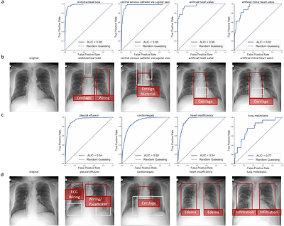 Reconstruction of Patient-Specific Confounders in AI-based Radiologic
  Image Interpretation using Generative Pretraining