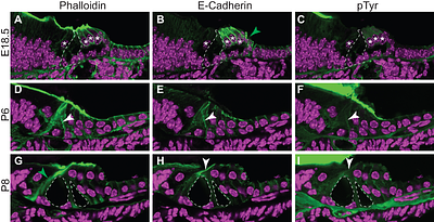 Changes in cell adhesion properties are associated with the formation of fluid-filled spaces in an epithelium.