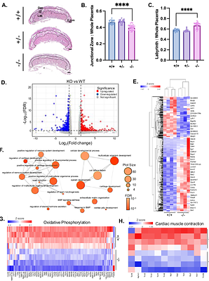 Cardiomyocyte-intrinsic SLC25A1 regulates cardiac differentiation and mitochondrial function