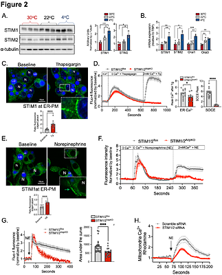 Ca2+ influx through ER-plasma membrane contacts is required for brown fat thermogenesis and metabolic health