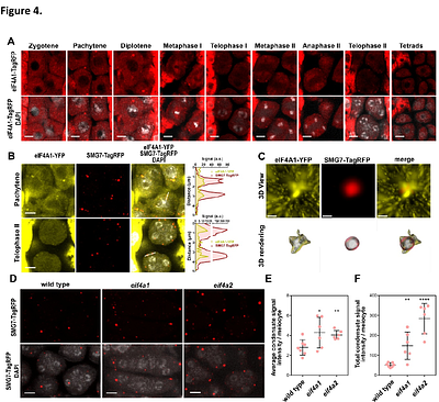 SMG7 and eIF4A constitute a homeostatic module controlling P-body condensation and function of Meiotic bodies